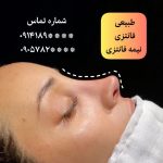 نمونه کار شیوا مالک