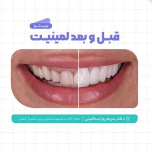 نمونه کار ادمین هستی لرستانی