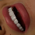 كامپوزيت شعبه vip