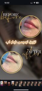نمونه کار ادمین عسل حاجی زاده