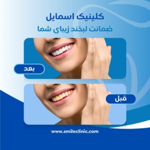 نمونه کار ادمین آیناز حصاری