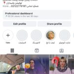تزریق ژل، بوتاکس، چربی، جوانسازی و لیفت صورت