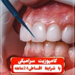 نمونه کار آرزو نصیری
