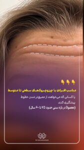 نمونه کار ادمین مهلا فاروقی