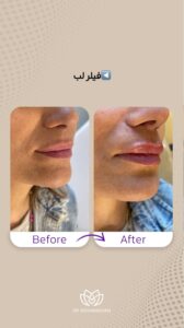 نمونه کار ادمین مهلا فاروقی