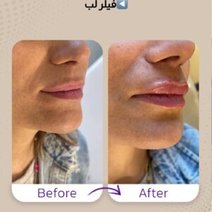 نمونه کار مهلا فاروقی