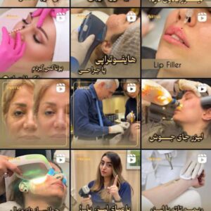 نمونه کار نیوشا ستارزاده