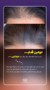 نمونه کار ادمین مهلا فاروقی
